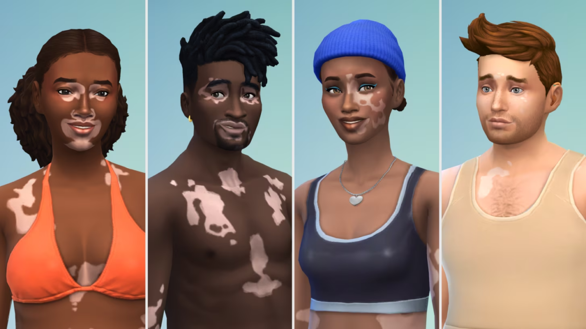Les Sims 4 - Le vitiligo pour toujours plus d'inclusivité